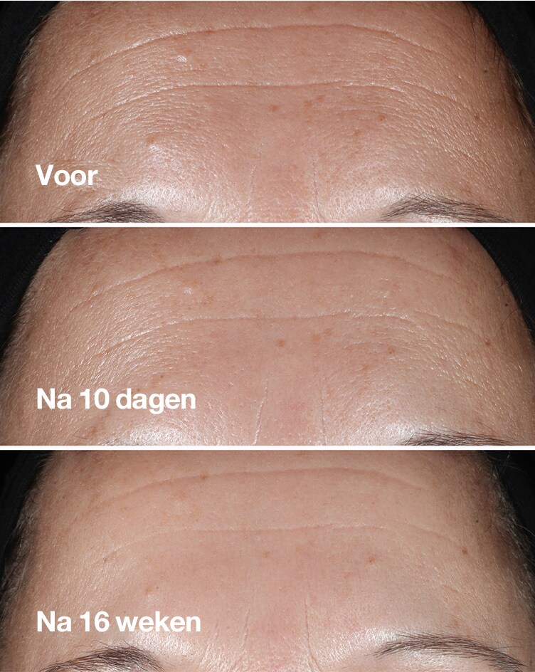 Een zichtbaar verschil.