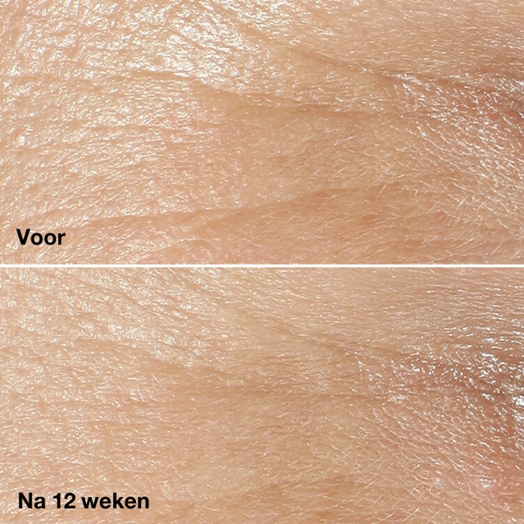 94% nam een gladdere huid waar. 84% zag zichtbare verjonging. 87% ervaart een vollere huid. *Consumententest bij 358 vrouwen n